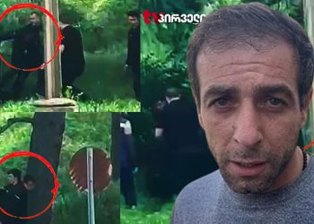 მე და ჩემი ძმაკაცი მაგრად გვცემეს – რას ამბობს პოლიციელების მიერ ნაცემი მამაკაცი?