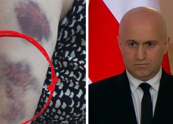 68 წლის პენსიონერი ამტკიცებს, რომ შსს–ს მასზე თავდამსხმელები არც კი გამოუკითხავს