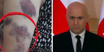 68 წლის პენსიონერი ამტკიცებს, რომ შსს–ს მასზე თავდამსხმელები არც კი გამოუკითხავს