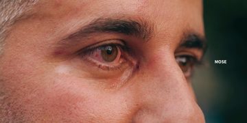 ფოტოგრაფ ლევან ზაზაძეს თავს დაესხნენ – დეტალები