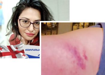 ,,ზონდერმა მანდატურებმა ჩემზე ფიზიკურად იძალადეს” – რუსკა მჭედლიძე