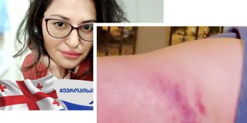 ,,ზონდერმა მანდატურებმა ჩემზე ფიზიკურად იძალადეს” – რუსკა მჭედლიძე